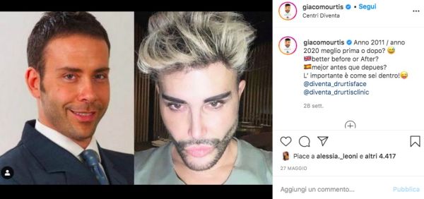 giacomo urtis prima e dopo